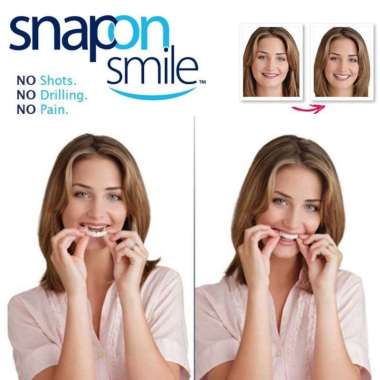 Gigi Palsu Lepasan Instan Snap On Smile 1 Set Atas Bawah Menutupi Gigi Ompong Gigi Tidak Rapih Snap 
