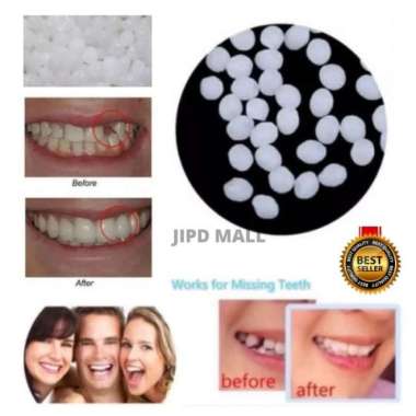 Temptooth Bahan Reparasi Buat Tambal Gigi Palsu Patah Isi 90bh 118112