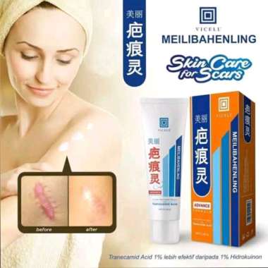 Hanasui Vicell Scar Treatment Meilibahenling Cream 60gr