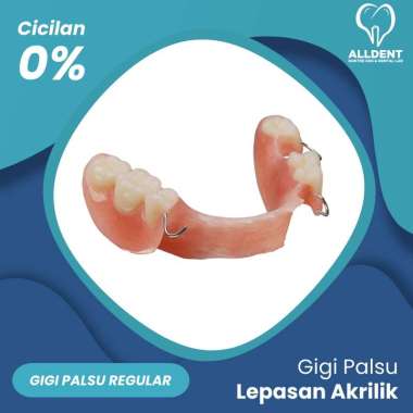Gigi Palsu Lepasan Akrilik