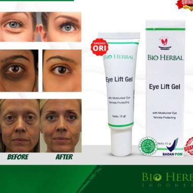 Bio Herbal Eye Lift Gel Penghilang Mata Panda Penghilang Kantung Mata Garansi Original BPOM
