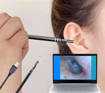 Korek Pembersih Kuping Telinga Kamera HD Visual USB Port Laptop Smartphone Sendok Stainles Steel LED