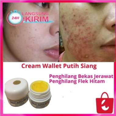 [100% Asli] Cream Walet Siang Super White Pemutih Wajah Penghilang Jerawat Penghilang Flek Hitam
