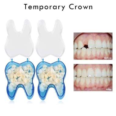Gigi Palsu Gusi penambal Gusi bagian bawah Gigi Gusi Teeth Crown