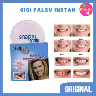 Gigi Palsu Instan Snap On Smile Authentic Veneer Atas Bawah