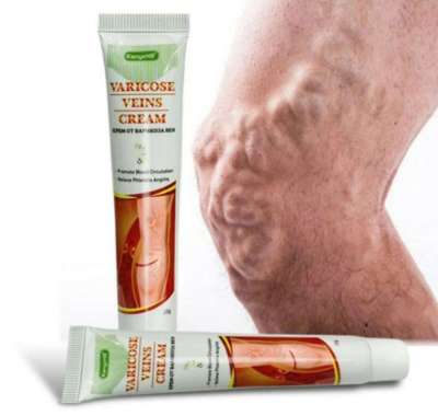CREAM ANTI VARISES CHPPER