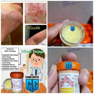 Batanta Store salep belerang krim gatal salep panu kurap scabis original ampuh