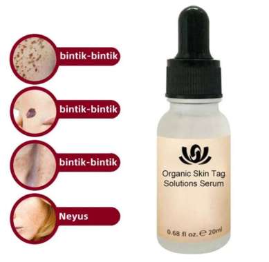 ORI 100% Rose Mole Serum Penghilang TahiLalat Kutil Skin Tag Remover 20ml/Menghilangkan Kutil/Pemuti
