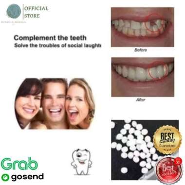 Jual Temptooth Temp Tooth Lem Gigi Palsu Bahan Tambal Temporary Penambal 5g  - Jakarta Barat - Behell Dental