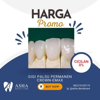 Gigi Palsu Permanen Crown-All Porcelain Emax