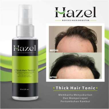 Penumbuh Rambut Kebotakan - Penumbuh Rambut Cepat Hazel Hair Tonic