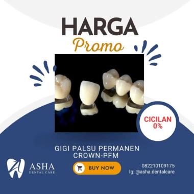 Gigi Palsu Permanen Crown- Metal Porcelain PFM