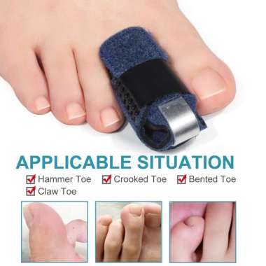 Trigger Finger Foot Splint Penyangga Pelurus Jari Kaki Patah Terkilir Kaki Kanan