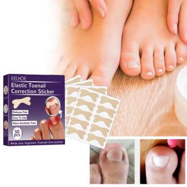Stiker Korektor Kuku Kaki Adhesive Ingrown Toenail Patch 50 Pcs Inserts Nail Groove Plester Kuku Kak