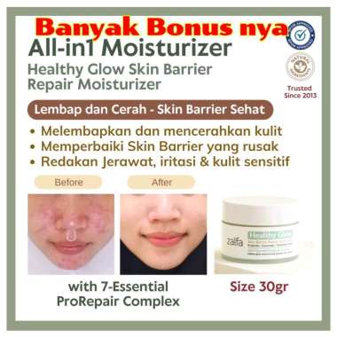 Zalfa natural Moisturizer 30 gram/krim satuan healthy glow 7 Days Healthier Skin Barrier Korean Hair