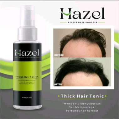 Hazel Hair Tonic - Penumbuh Rambut Kebotakan | Penumbuh Rambut Cepat Default