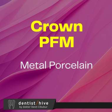 Crown Gigi PFM bahan metal porcelain pergigi