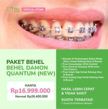 FDC Dental Clinic - Behel Damon Quantum