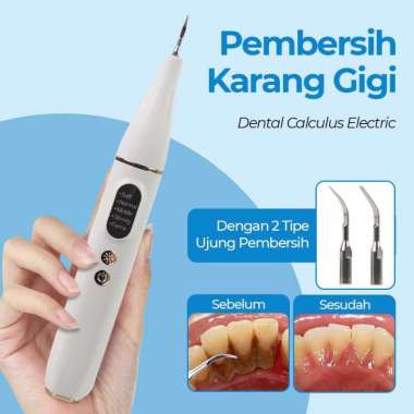 Scaling Alat Pembersih Karang Gigi Ultrasonic Dental Calculus Electric