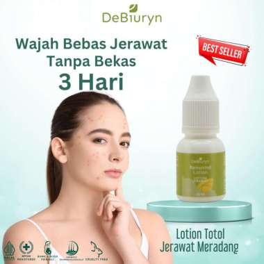DeBiuryn Removind Acne Spot Lotion 10ml - Losion Totol Jerawat