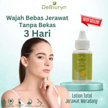 DeBiuryn Removind Acne Spot Lotion 30ml Losion Totol Jerawat Ampuh