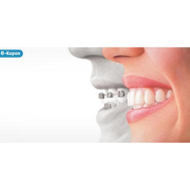 Jual HD Dental Paket D E-Voucher [Konsultasi/General Check 