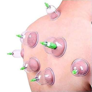 Alat Bekam 12 Cup Kop Sammora Samora Cop Angin Badan Vacuum Cupping Cup Kit Therapi