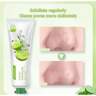 【READY STOCK】CINDYNAL x OULISI Fruit Acid Exfoliating Gel 30 Gr Facial Glowing Blackhead Cleaner Bod