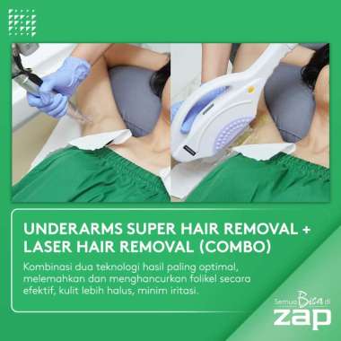 Underarm Combo (Super Hair Removal + Laser Hair Removal) - ZAP Premier