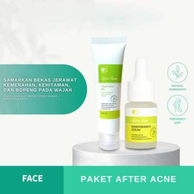 Larissa Paket Bekas Jerawat - After Acne Serum + After Acne Treatment Gel