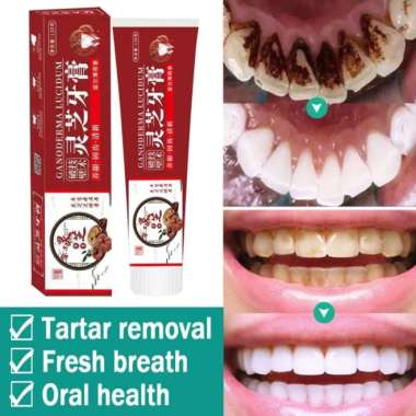 ORI 100% Pasta Gigi Berlubang Penumbuh Gigi Odol pemutih gigi dan karang gigi Pembersih gigi kuning 