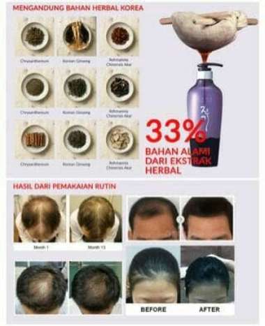 Daeng Gi Meo Ri 500ml BIG SIZE!!! Korean Vitalizing Shampoo
