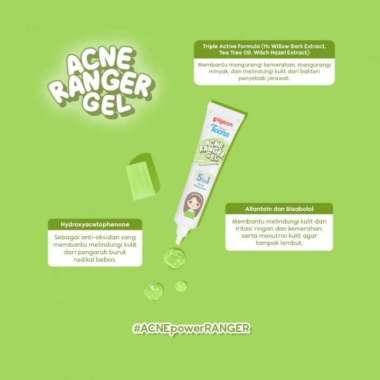 PIGEON Teens Acne Ranger Series | Skincare Perawatan Wajah GEL 15ML