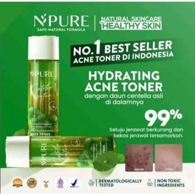 Npure Acne Face Toner Centella Asiatica Cica Series Toner Centella