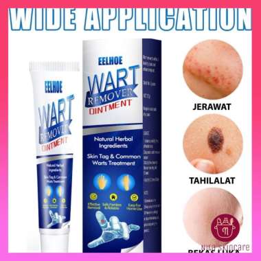 Krim Penghilang Tahi Lalat Sumifun Wart Remover Krim Ampuh Menghilangkan Tahi Lalat di Wajah dan Kut