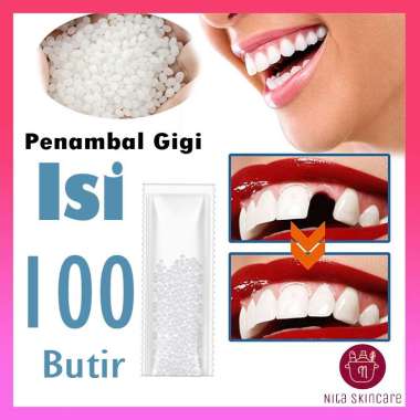 100 Butir Penambal Gigi Berlubang Gigi Depan Ompong ORIGINAL Gigi Palsu Original Penutup Gigi