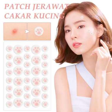 Acne Patch Sticker Jerawat Lucu Bentuk Hati Bintang Invisible Pimple Patch Stiker Cute - Heaven Beau