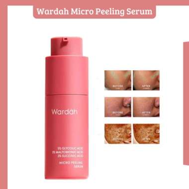Wardah 5% Glycolic Acid Micro Peeling Serum 20ml - Serum Wajah