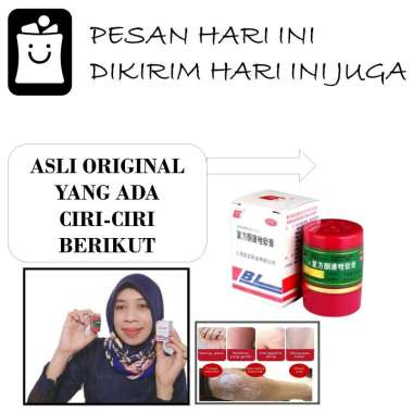 Salep Gatal Cina Salep Kulit Eksim Gatal Selangkangan Jamuran Jerawat Kudis Kutu Air Panu