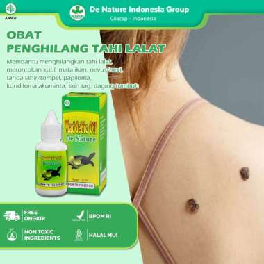 Kutil dan Tahi Lalat? Hilang Tanpa Operasi dengan Produk Ini! Salep ANPILOMA MADDEBIC OIL De Nature
