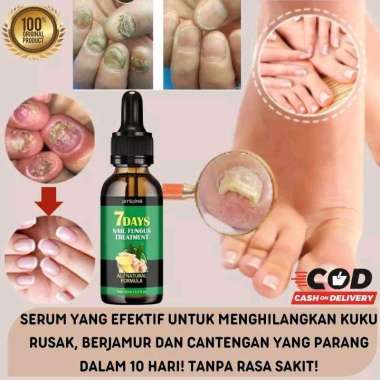 serum penghilang jamur kuku Z4 / jaysuing nail serum penghilang jamur kuku