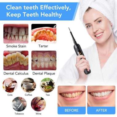 Hailicare Pembersih Gigi Elektrik Dental Tartar Remover with LCD LR-6 Hitam
