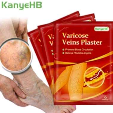 Kanye HB koyo vericose varises