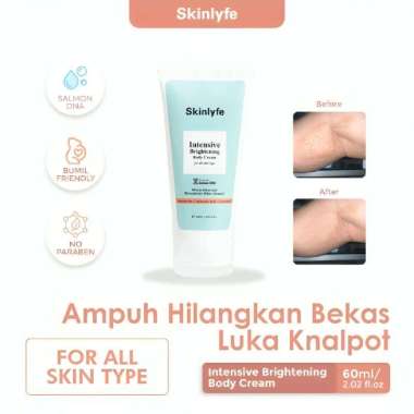 Skinlyfe Cream Pencerah Badan Penghilang Bekas Luka Hitam Koreng Cream Strechmark Salep Bekas Luka