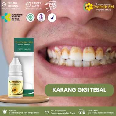 Pembersih karang gigi Penghilang karang gigi membandel, Pemutih Gigi Kuning Kerak Penghilang Karang,