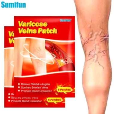 sumifun Vericose patch koyo varises