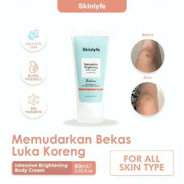 Skinlyfe Penghilang Bekas Luka Hitam Koreng Cream Pencerah Badan Salep Bekas Luka Menahun BPOM