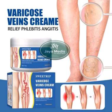 SWEETRIP Cream Varises- Salep Varises SOUTH MOON