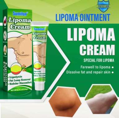 Krim Lipoma Krem Lipoma Salep Penghilang Lemak Tubuh Perawatan Tubuh Lainnya 1pc lipoma cream