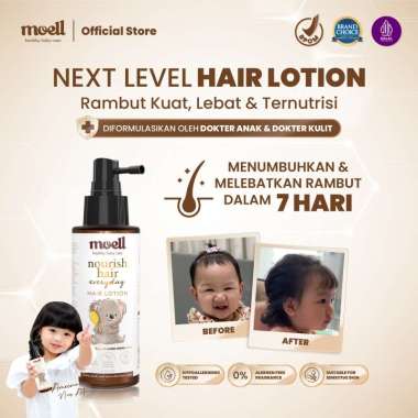 Moell Hair Lotion 100ml Dengan Panax Ginseng, Kemiri, Biotin - Menumbuhkan & Melebatkan Dalam 7 Hari